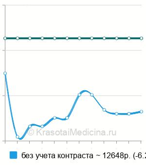 Средняя стоимость МРТ кишечника в Санкт-Петербурге