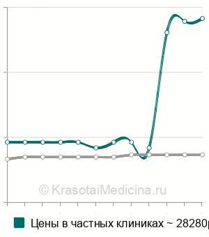 Средняя стоимость эндосонографии желчных путей в Санкт-Петербурге