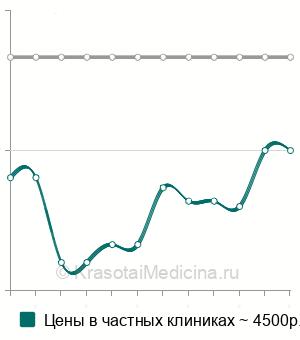 Средняя стоимость контрастирования при МРТ в Санкт-Петербурге