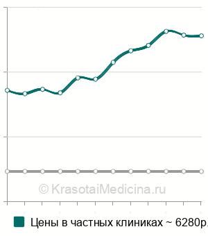 Средняя стоимость МРТ кисти в Санкт-Петербурге
