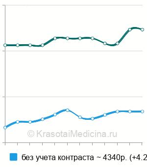 Средняя стоимость МРТ артерий шеи в Санкт-Петербурге