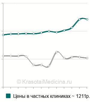 Средняя стоимость анализ на антитела к дифтерийной палочке в Санкт-Петербурге