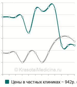 Средняя стоимость анализ на антитела к возбудителю фасциолеза в Санкт-Петербурге