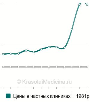 Средняя стоимость анализ на антиовариальные антитела в Санкт-Петербурге