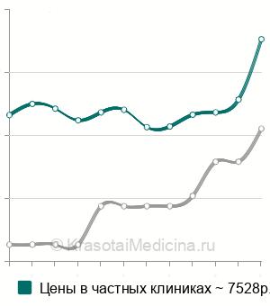 Средняя стоимость антител к ганглиозидам в Санкт-Петербурге