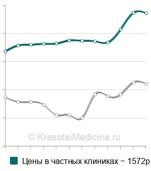 Средняя стоимость анализа на онкомаркер CYFRA 21-1 в Санкт-Петербурге