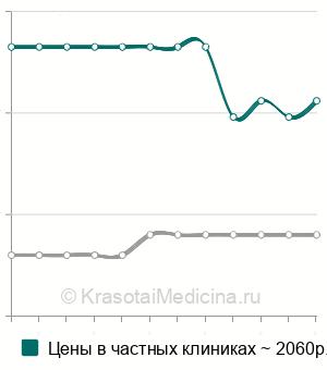 Средняя стоимость рентгенографии сердца с контрастированием пищевода в Санкт-Петербурге
