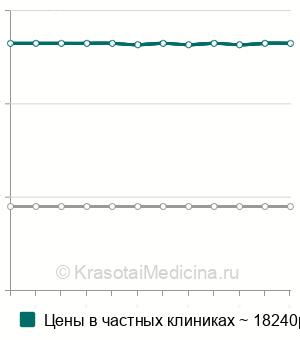 Средняя стоимость переливание тромбоцитарной массы в Санкт-Петербурге