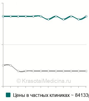 Средняя стоимость наложения трансверзосигмоанастомоза в Санкт-Петербурге