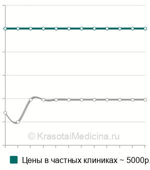 Средняя стоимость КТ органов грудной клетки ребенку в Санкт-Петербурге