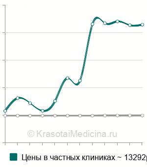 Средняя стоимость изготовления хирургического шаблона в Санкт-Петербурге