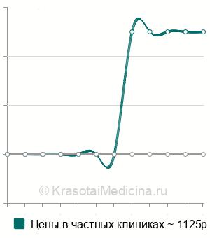 Средняя стоимость консультация рентгенолога в Санкт-Петербурге