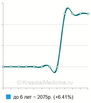 Средняя стоимость ЭЭГ с проведением функциональных проб ребенку в Санкт-Петербурге