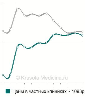 Средняя цена на эндоскопическую биопсию пищевода в Санкт-Петербурге