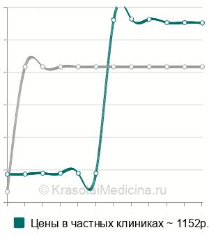Средняя стоимость кератотопография (корнеотопография) в Санкт-Петербурге