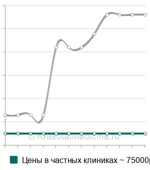 Средняя стоимость эмболизация варикозных вен пищевода и желудка в Санкт-Петербурге