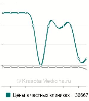 Средняя стоимость инъекции Луцентис в Санкт-Петербурге