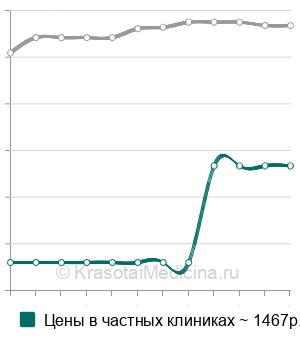 Средняя стоимость биопсия миндалин в Санкт-Петербурге