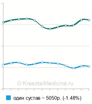 Средняя стоимость МРТ коленного сустава в Санкт-Петербурге