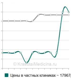 Средняя стоимость артроскопическое удаление свободных внутрисуставных тел локтевого сустава в Санкт-Петербурге
