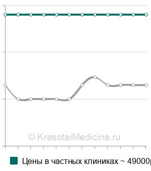 Средняя стоимость дистальной резекции поджелудочной железы в Санкт-Петербурге