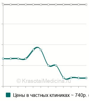 Средняя стоимость эхосинусоскопии (синускан) в Санкт-Петербурге