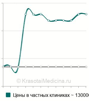 Средняя стоимость удлинение полового члена в Санкт-Петербурге