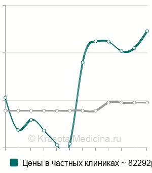 Средняя стоимость ведение беременности 1-3 триместр в Санкт-Петербурге
