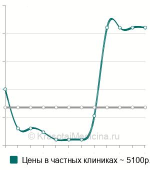 Средняя стоимость репозиция шейки плечевой кости в Санкт-Петербурге