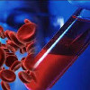 Анализ крови на эозинофильный катионный белок