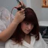 Электростимуляция волосистой части головы