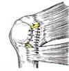 Артроскопический тенодез сухожилия двуглавой мышцы плеча