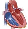 Вентрикулография сердца