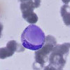 Анализ крови на LЕ-клетки