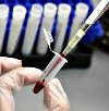 Курс лечения серорезистентного сифилиса