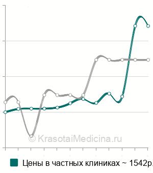 Средняя стоимость анализ на антитела к C1q фактору комплемента в Санкт-Петербурге