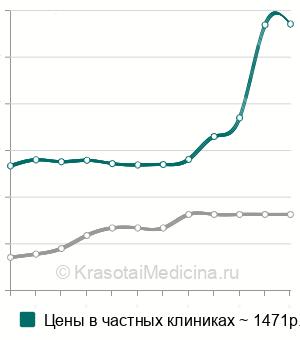 Средняя стоимость анализ на антитела к миелопероксидазе (МРО) в Санкт-Петербурге